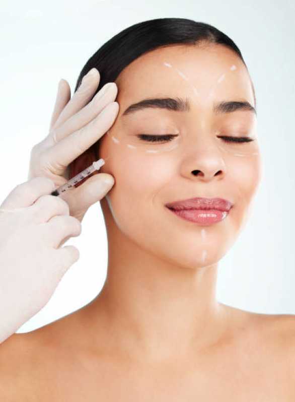 Aplicação de Botox Bruxismo Residencial Vale do Sol - Aplicação de Toxina Botulínica na Face