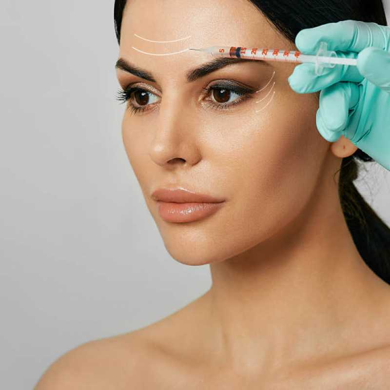 Aplicação de Botox Facial Clínica Jardim Primeiro de Maio - Aplicação de Botox na Testa