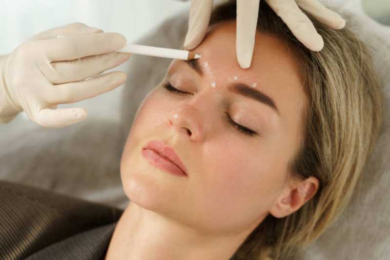 Aplicação de Botox Full Face Condomínio Refúgio Pinheiros - Aplicação de Botox no Rosto