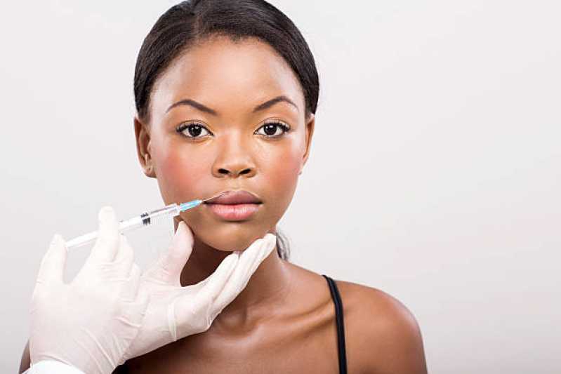 Aplicação de Botox na Testa Parque Primavera - Aplicação de Toxina Botulínica na Face
