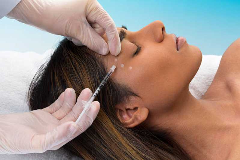Aplicação de Botox para Bruxismo Ipês - Aplicação de Toxina Botulínica na Face