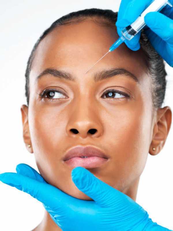 Aplicação de Toxina Botulínica na Face Clínica Jardim Clementino - Aplicação de Botox Facial