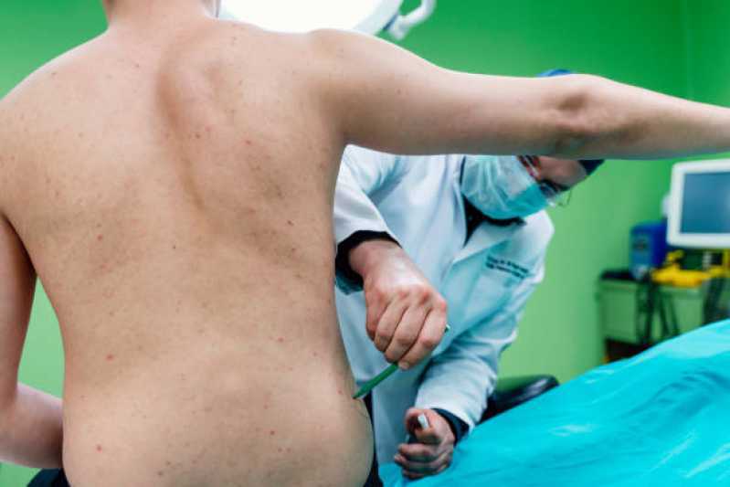 Cirurgia de Dermolipectomia Coxas Clínica Recanto Verde Lagos - Cirurgia de Dermolipectomia de Dorso