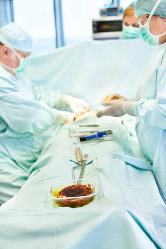 Cirurgia de Ginecomastia Bilateral Masculina Jardim Maristela - Operação de Ginecomastia