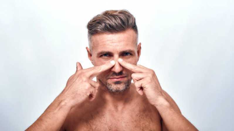 Cirurgia de Rinoplastia Reparadora Marcar Vila Sol - Cirurgia para Correção da Estética Nasal