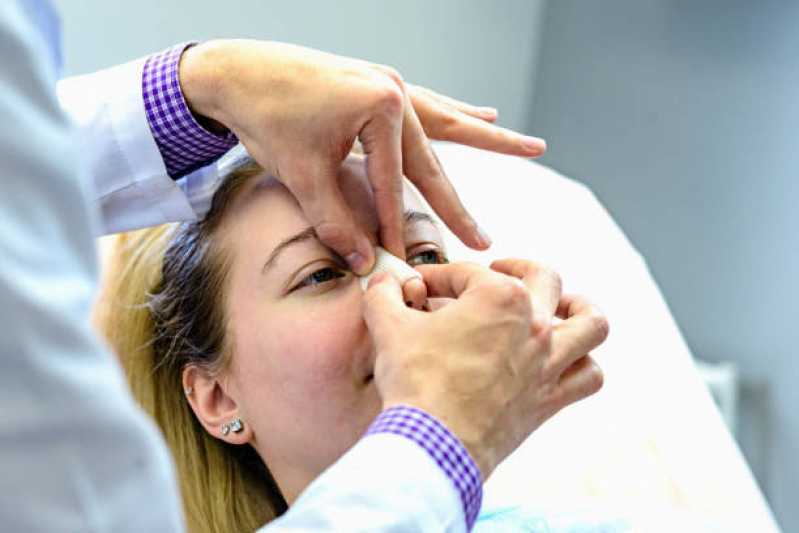 Cirurgia de Rinoplastia Reparadora Parque Ribeiro de Lima - Cirurgia para Correção da Estética Nasal