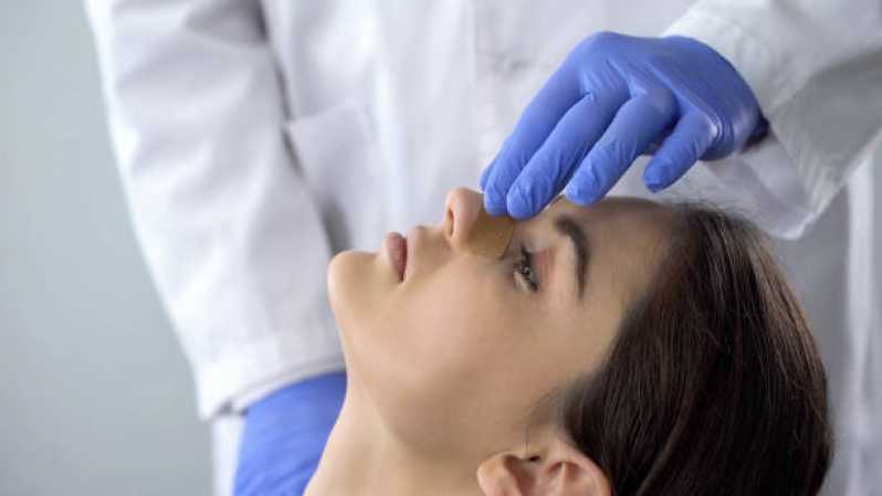 Cirurgia de Rinoseptoplastia Marcar Cidade do Sol - Cirurgia para Correção da Estética Nasal