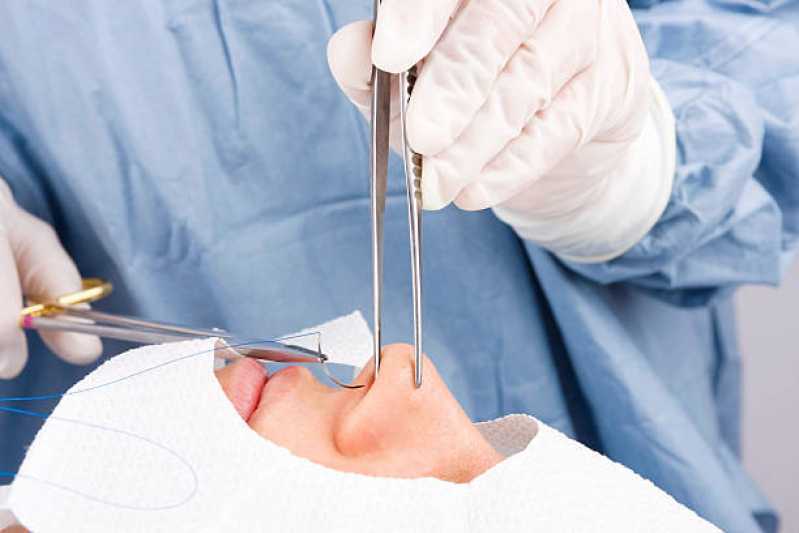 Cirurgia no Nariz Marcar Vila Creti - Cirurgia para Diminuir o Nariz