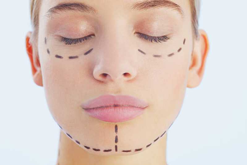 Cirurgia Plástica Facial Chácara Peroba - Cirurgia Plástica no Rosto