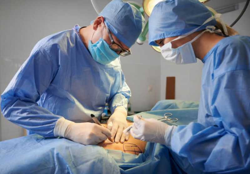 Cirurgia Plástica na Barriga Clínica Aliança - Cirurgia Plástica Lipoescultura