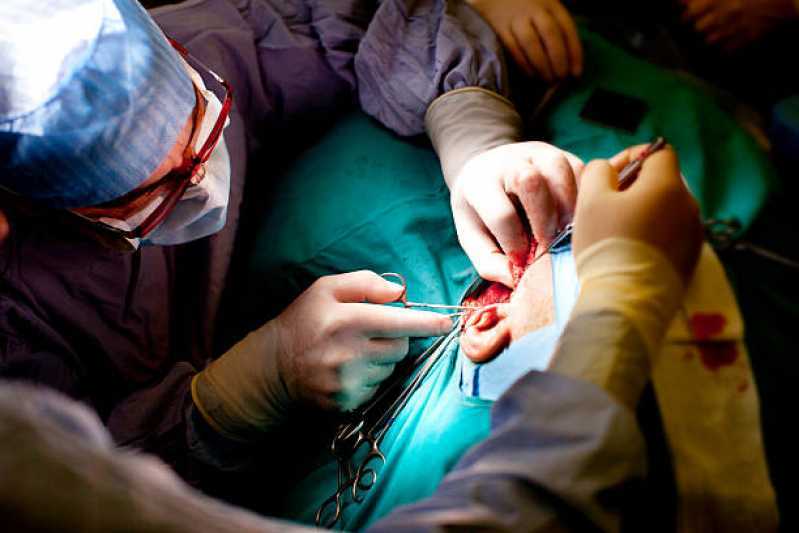 Cirurgia Plastica na Orelha Jardim Mutinga - Cirurgia Lobuloplastia