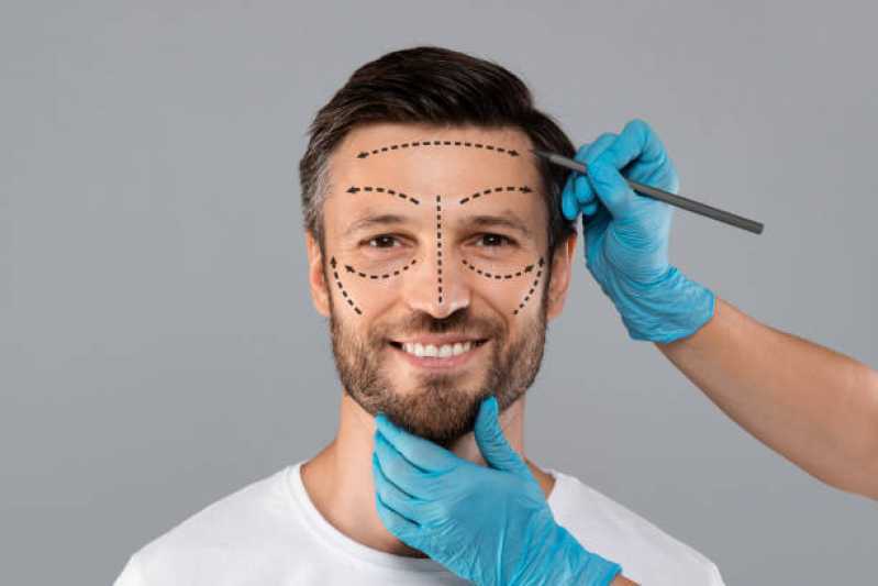 Cirurgia Plástica no Rosto Adalgisa - Cirurgia Plástica Facial