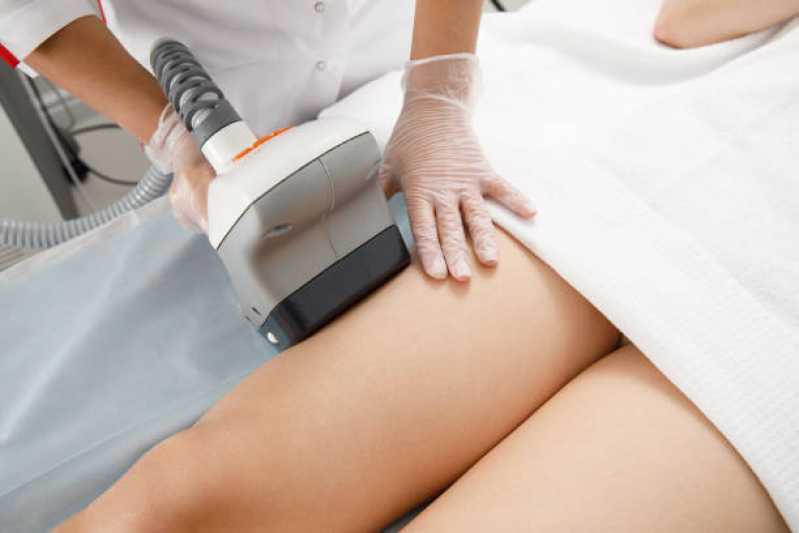 Clínica Especialista em Tratamento Celulite e Flacidez Mutinga - Tratamento para Celulite nas Pernas