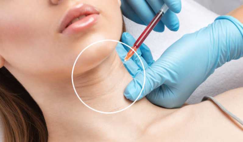 Clínica Especializada em Aplicação de Botox Boca Alphaville Centro Apoio I - Aplicação de Botox na Testa