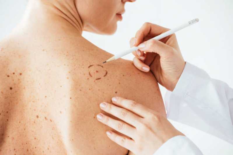 Envelhecimento Saudável Marcar Recantinho - Medicina Estética Dermatologia Carapicuíba