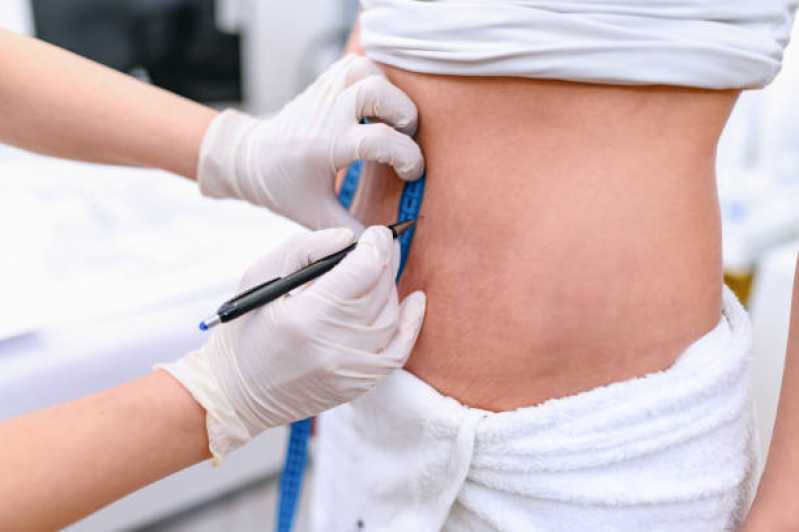 Lipoabdominoplastia com Enxerto Clínica Jardim Julieta - Lipoabdominoplastia e Mamoplastia