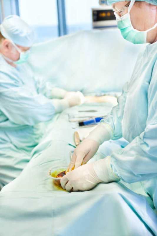 Mamoplastia Redutora Cirurgia Agendar Água Fria - Mamoplastia Redutora com Prótese Carapicuíba