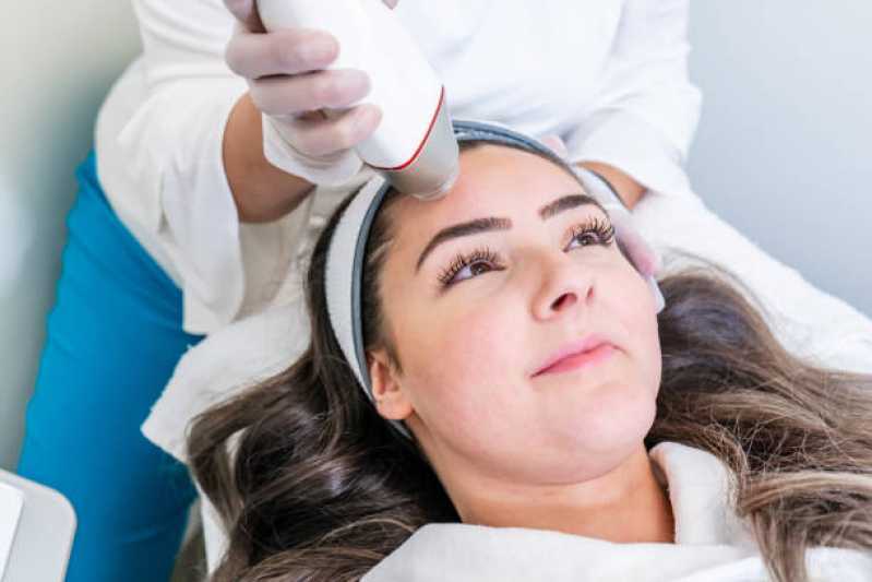 Microagulhamento para Tratamento Capilar Agendar Chácara Santa Lúcia - Microagulhamento Facial Osasco