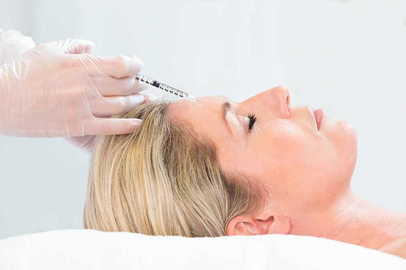Onde Fazer Aplicação de Botox na Testa Vila Áurea - Aplicação de Botox Rosto