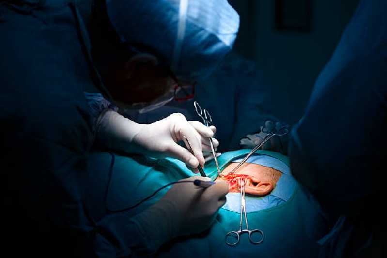 Onde Fazer Cirurgia de Orelha Rasgada Sítio Guarehy - Cirurgia de Otoplastia
