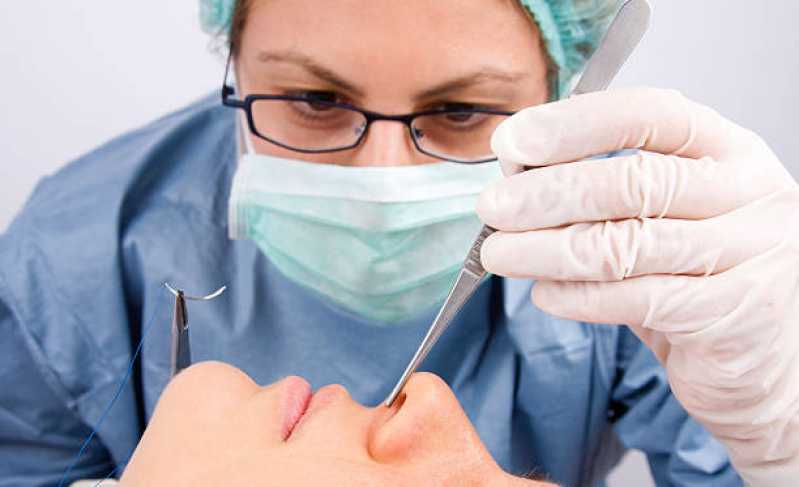 Onde Fazer Cirurgia no Nariz Vila Freitas - Cirurgia para Correção da Estética Nasal
