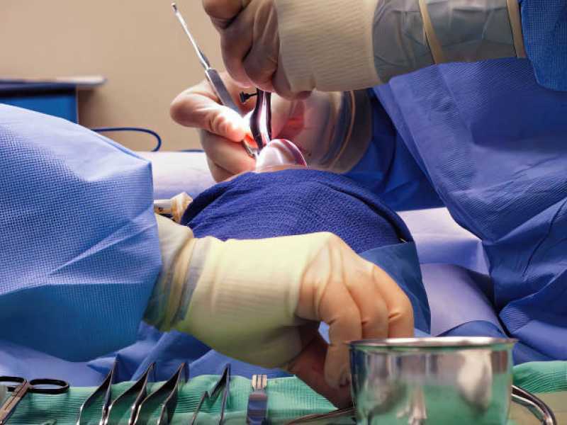 Onde Fazer Cirurgia para Afinar o Nariz Aliança - Cirurgia Plástica no Nariz