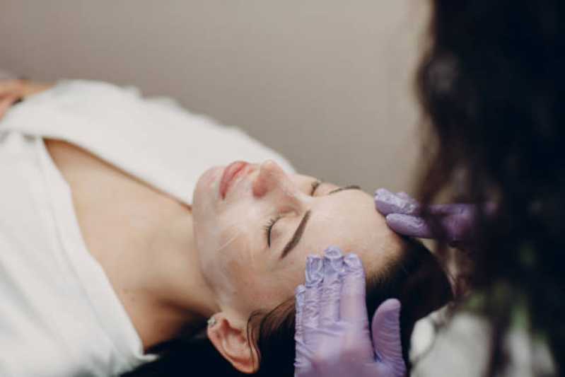 Onde Tem Peeling Químico para Acne Empresarial Anhanguera - Peeling Facial de Diamante Profissional
