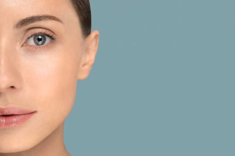 Peeling Químico para Acne Clínica Nova Itapevi - Peeling Facial