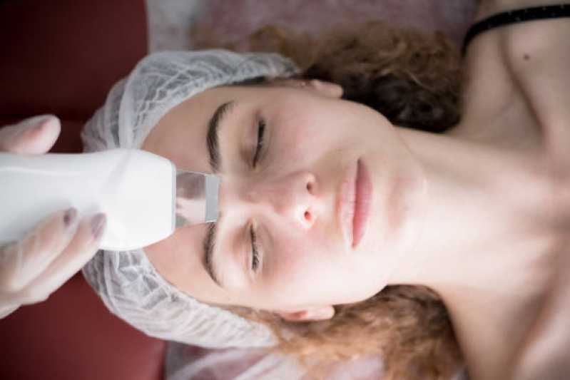 Peeling Químico para Acne Vila Teresa - Peeling Facial de Diamante Profissional