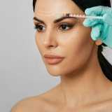 aplicação de botox facial clínica Jardim Pedras