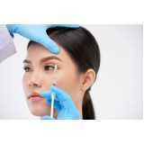 aplicação de botox rosto clínica Vila Amaral