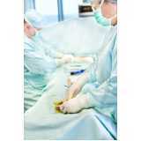 cirurgia de ginecomastia bilateral masculina marcar Parque Santa Teresa