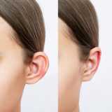 cirurgia de orelha rasgada marcar Jardim Pedras