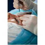 cirurgia pálpebra Centro Jandira