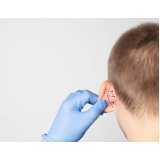 clínica que faz cirurgia orelha rasgada Parque Flórida