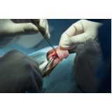 clínica que faz cirurgia otoplastia Itapevi